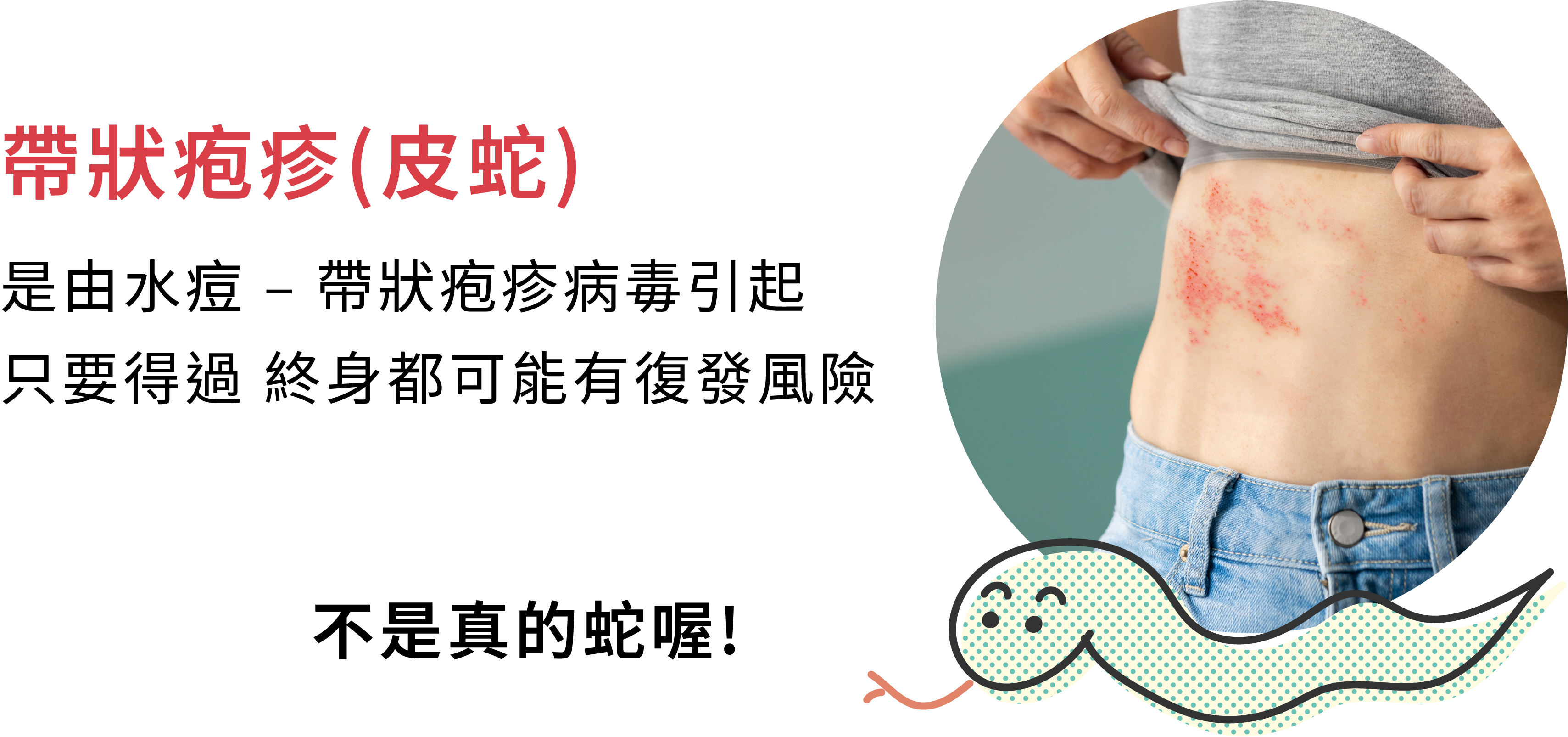 年長者皮蛇介紹